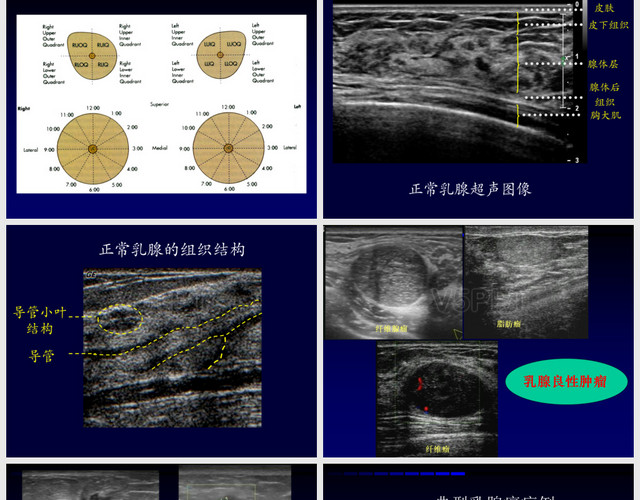 乳腺腫物護(hù)理查房PPT模板