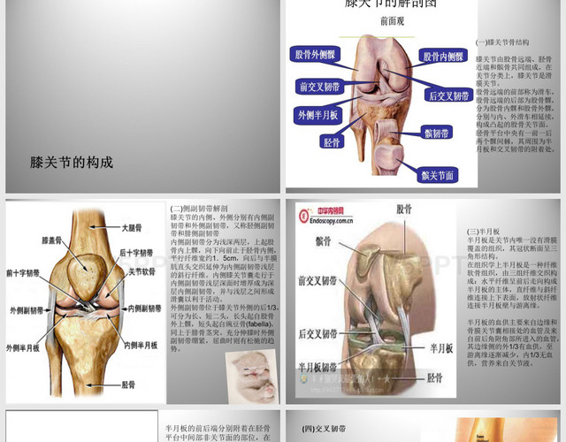 护理膝关节骨性关节炎PPT